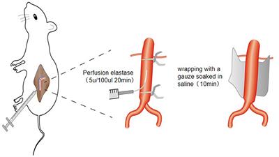 Establishment of a New Abdominal Aortic Aneurysm Model in Rats by a Retroperitoneal Approach